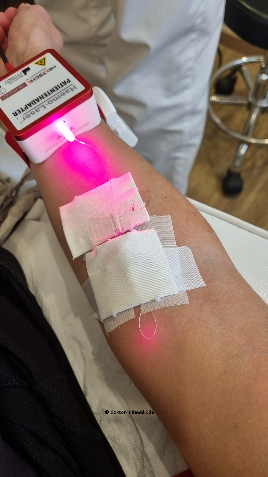 Das Bild zeigt eine medizinische Anwendung der Haemo-Laser-Therapie. Ein Patient hat eine Kanüle im Arm, durch die ein hochreines Laserlicht direkt in die Blutbahn geleitet wird. Das Laserlicht erscheint als intensiver pinkfarbener Strahl, der aus einem angeschlossenen Gerät austritt.  Die Kanüle ist mit weißen medizinischen Pflastern fixiert, um einen sicheren Halt zu gewährleisten. Im Hintergrund ist eine Person in weißer Kleidung zu sehen, vermutlich medizinisches Personal, sowie eine Metallstuhl mit Rollen, der auf eine klinische Umgebung hinweist.  Auf dem unteren Teil des Bildes ist die Website doktor-milewski.de sichtbar, was darauf hindeutet, dass die Therapie in der Praxis von Dr. Milewski angeboten wird.